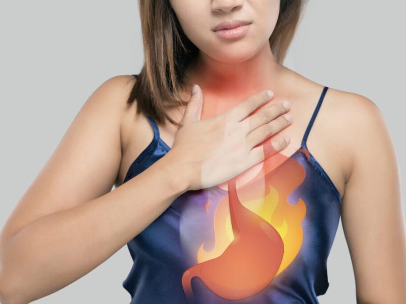 When Heartburn Is More Than Just Heartburn